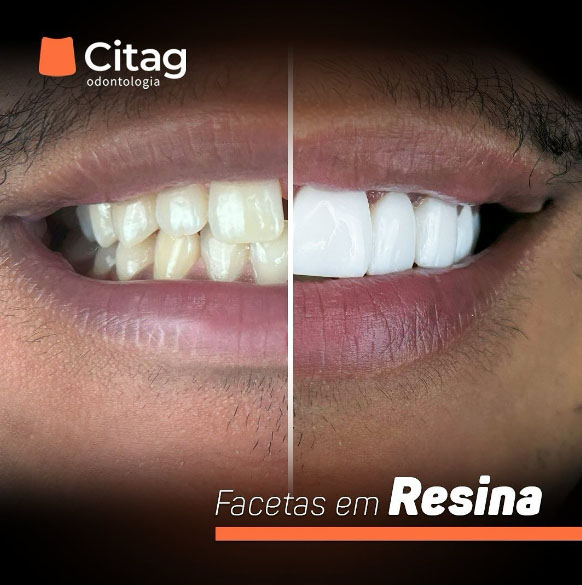 Banner Página Convênio - Citag